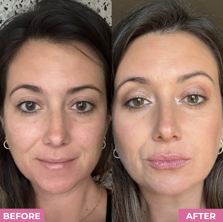 Kiss + Glow LipBoost Kit